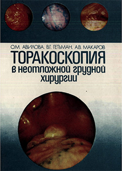 Торакоскопия в неотложной грудной хирургии
